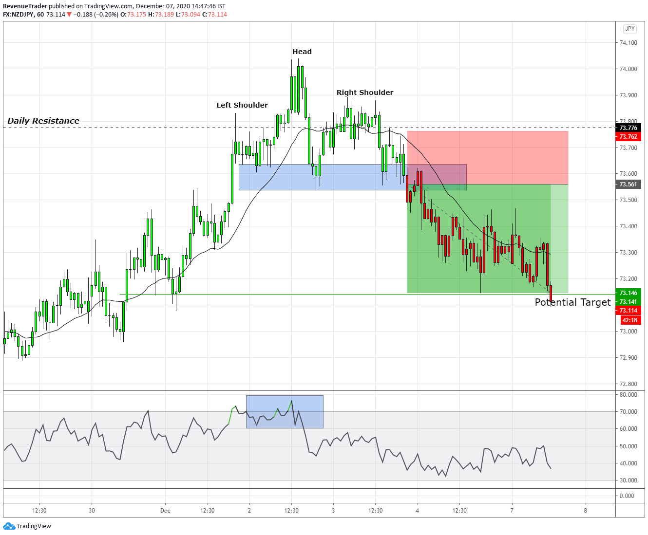 2R on NZDJPY