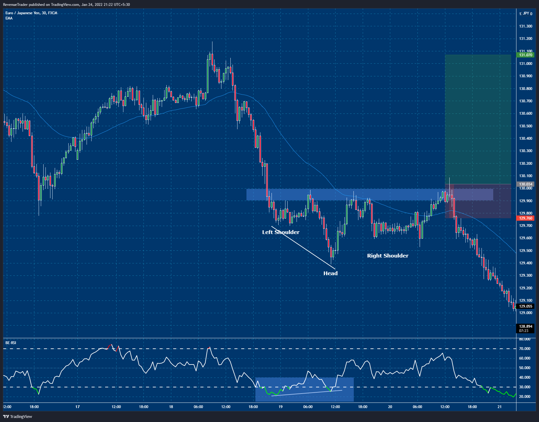 EURJPY Long Trade - One and Only Loser of the Month